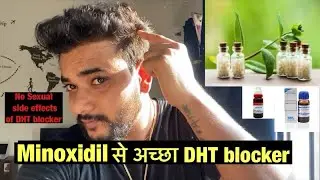 100 % effective Homeopathic DHT blocker Combination Without any Side effects| Regrow your hair