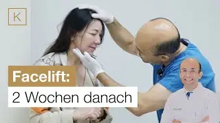 2 Wochen nach dem Facelift: Das sagt die Patientin