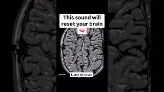 Sound To reset your brain 🧠 || and improve focus  #focus #motivation #neet #braintricks #shorts