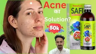 Safi Syrup सच में Acne ठीक करता है? | Honest Review | Blood Purifierx