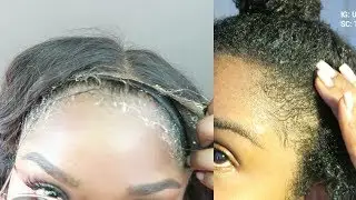 Frontals/wigs broke off my edges!? No more wigs! Heat damage? Natural hair update!