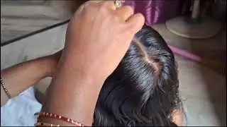 request oil hair nitpicking heavy lice white cloth lice comb real sound#youtube#