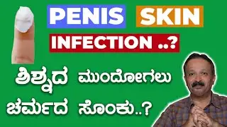 Penis skin / Foreskin Infection #ಶಿಶ್ನದ ಮುಂದೋಗಲು ಚರ್ಮದ ಸೊಂಕು?@ Sex education in Kannada