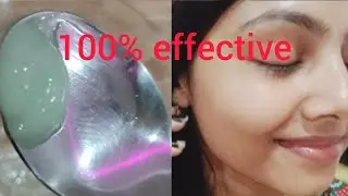 Get korean like  glass skin at home| remove any spots from face| spotless glowing skin