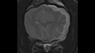 MRI Case Challenges