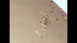 nematode attacking cyclopoid