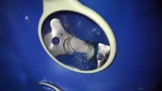 Continuous Heat Wave Compaction technique  CWC ( Endodontic Obturation )