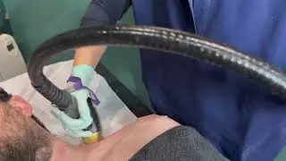 Laser Hair Removal - Soprano Titanium