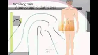 UCSF Radiology: The Tools of Interventional Radiologists