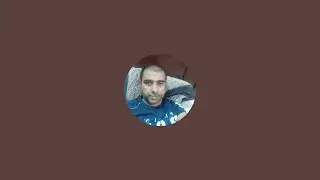 Mudassar bilal Butt is going live! back eyes infection