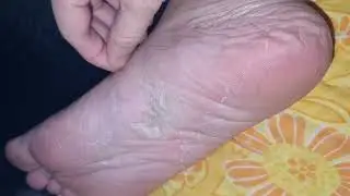 I TRIED THIS FOOT PEEL MASK ITS REMOVE MY OLD SKIN SO AMAZING RESULT # short
