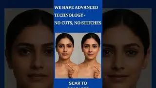 Would you still choose a treatment with scars, cuts & stitches? #varicoseveins #scarlesssurgery