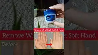 💥Remove Wrinkles & Get Soft Hands#skincare #wrinkles#skincaretips#glowingskin#skincareroutine#shorts