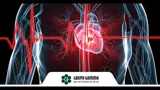 Evento M&eacute;dico | Ateneo Cardiolog&iacute;a | Amiloidosis Card&iacute;aca | Grupo Gamma