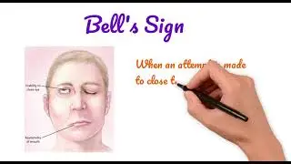 Part-5 | Bell&rsquo;s Sign | Quick Review