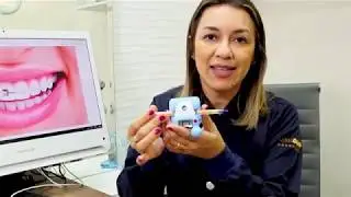 CONHEÇA O APARELHO AUTOLIGADO (RESULTADO MAIS RÁPIDO)