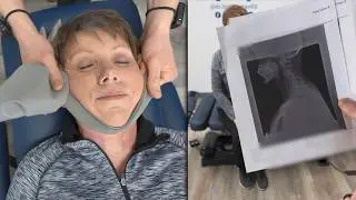 Her X-Rays Revealed Something I Wasn&rsquo;t Expecting