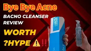Bacno Cleanser Honest Review | Bacno Clarifying Foaming Gel Cleanser | Acne Pimple @DaisyMinha 