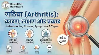 Gathiya (Arthritis) Ke Lakshan: Why Lifestyle & Diet Matter More Than You Think