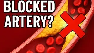 Leg Pain from Diabetes? Watch This Now 😱