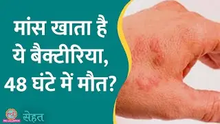 Japan में फैल रही अजीब बीमारी STSS क्या है, जो 'Flesh Eating Bacteria' से हो रही? | Sehat ep 906