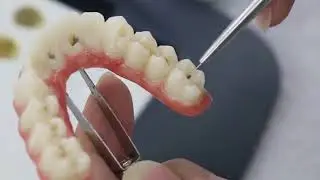 Bloc zircone UPCERA