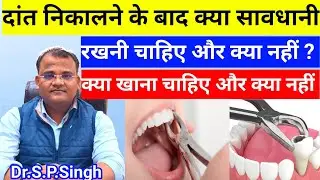 दांत निकालने के बाद क्या सावधानी रखनी चाहिए और क्या नहीं || क्या खाना चाहिए और क्या नहीं || 