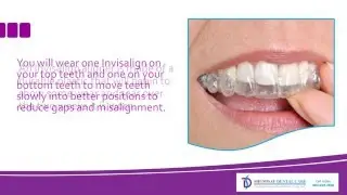 The Visible Difference Between Invisalign and Braces