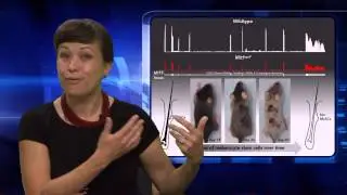 Identifying Genetic Modifiers of the Age-related Phenotype of Hair-graying - Melissa Harris