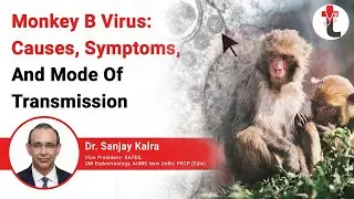 Monkey B Virus: Causes, Symptoms, And Mode Of Transmission || Monkey B Virus