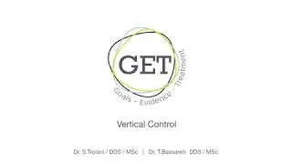 Vertical control Parte 1