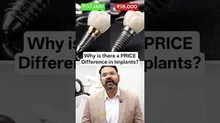 Why is there a PRICE Difference in Implants? Why do implants cost so high? Ivory Dental Clinic