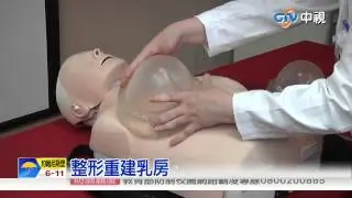 【中視新聞】體脂豐胸成功 半百婦變美胸女 20150611