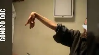 Ath&eacute;tose : mouvement anormal
