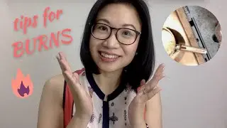 TIPS for your child's burn injuries and how to prevent burn accidents | Dr. Kristine Alba Kiat