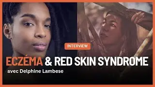 Eczéma et l'enfer du Red Skin Syndrome avec Delphine Lambese