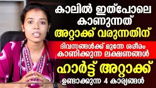 കാലിൽ ഇത്പോലെ കാണുന്നത് അറ്റാക്ക് വരുന്നതിന് മുമ്പ് ശരീരം കാണിക്കുന്ന ലക്ഷണങ്ങളാണ്!!!