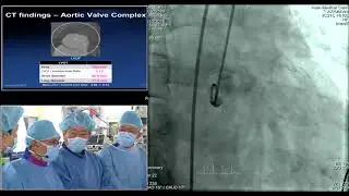 [AP VALVES 2018] Live Case I