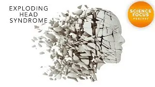 Exploding Head Syndrome