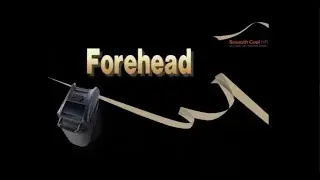 [Jeisys] Forehead Line Part Treatment - SmoothCool