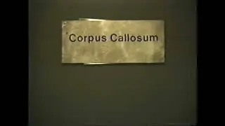 FILM OF THE DAY: *Corpus Callosum (2002)