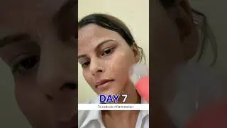7day ice rubbing on face | Ice for face | face icing benefits #beautytips #ashortaday #skincare