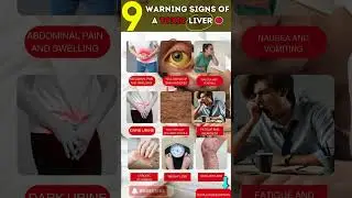 9 Warning Sign of A Toxic Liver