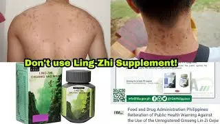 Beware of this Supplement! Ling-Zhi Ginseng, Chuang Yao Wan, Pambataba ng supplement