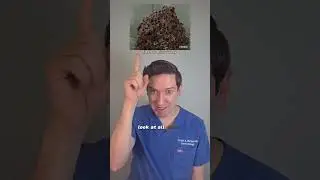 Homemade Coffee Scrub/Mask: Dermatologist Reacts #coffeescrub #exfoliation #derm #diy