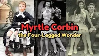 The Extraordinary Life of the Four-Legged Girl: Josephine Myrtle Corbin #myrtlecorbin