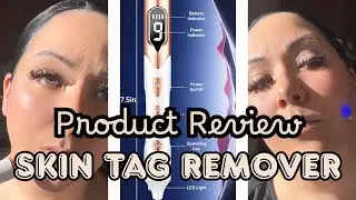 At-Home Skin Tag Remover Pen | Easy & Affordable Skincare Solution!