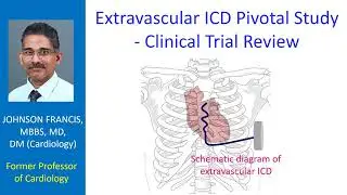 Extravascular ICD Pivotal Study - Clinical Trial Review
