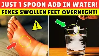 DOCTORS WARN: NIGHTTIME LEG SWELLING Signals Poor CIRCULATION &mdash; Here&rsquo;s the FIX