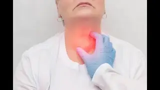 Thyroglossal Duct Cyst | Embryonic remnant | Hyperthyroidism | Thyrotoxicosis | Multi Nodular Goitre